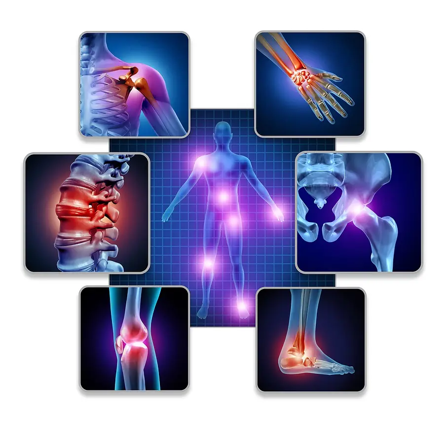 Anatomical diagram showing human body with highlighted joint pain areas including shoulder, hand, spine, hip, knee, and ankle with glowing inflammation indicators